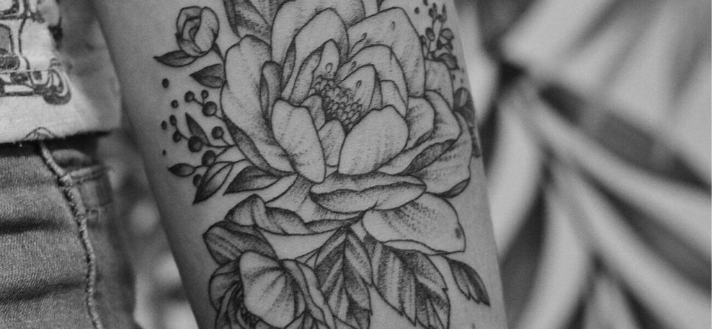 Rimozione di un tatuaggio